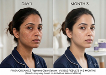 Load image into Gallery viewer, Prisa Organics Pigment Clear Serum 3% Tranexamic Acid 1% Kojic Acid 1% Alpha Arbutin Targets Pigmentation & Dark Spots 30ml