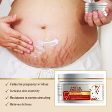 Load image into Gallery viewer, Stretch Mark Removal Cream to Reduce Stretch Marks, Scars,Spots, Discolouration,100 gm